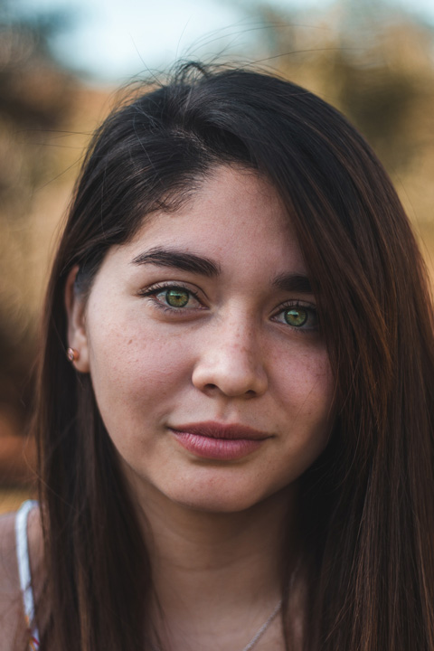 肌が荒れている女性の写真